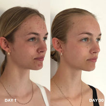 Load image into Gallery viewer, Clinisoothe Skin Purifier

