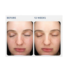Load image into Gallery viewer, PCA Skin Triple Exfoliation Peel Pads ￼
